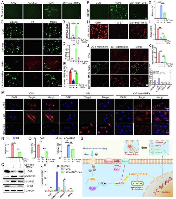 機(jī)械超負(fù)荷通過(guò) Piezo1 通道促進(jìn)鈣內(nèi)流誘導(dǎo)骨關(guān)節(jié)炎中 GPX4 調(diào)節(jié)的軟骨細(xì)胞鐵死亡